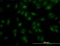 MAK Antibody (monoclonal) (M02)
